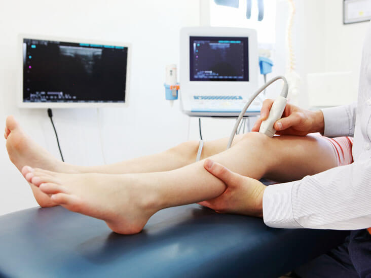 What Is A Vein Ultrasound?