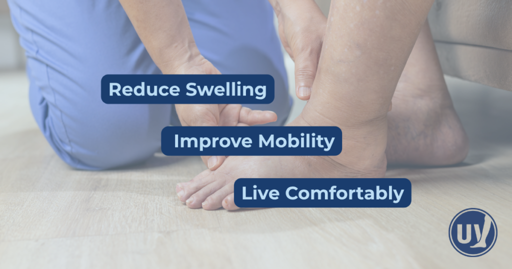 Graphic explaining how treating lymphedema will help reduce swelling and improve mobility