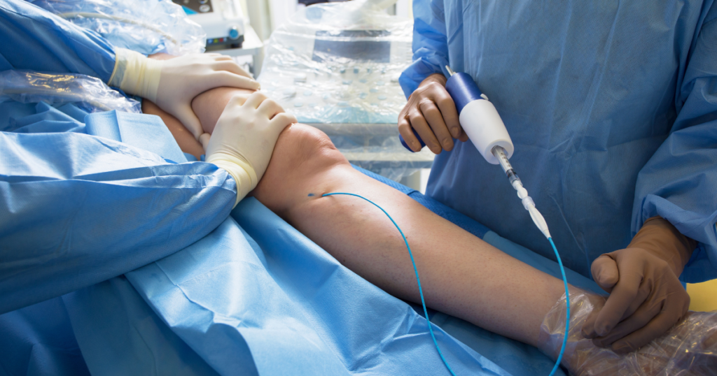 Vein specialists performing vein treatment on patients legs