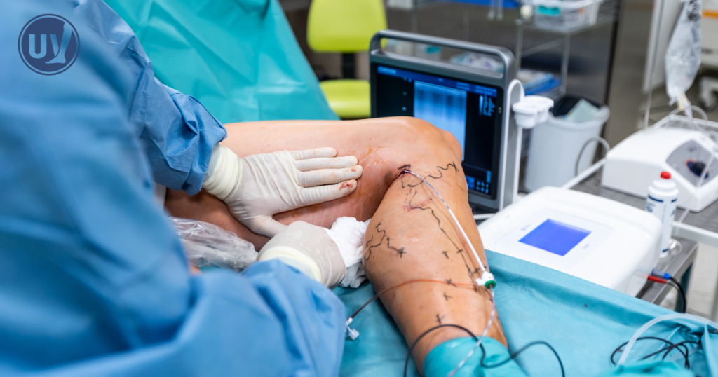 Vein specialist performing varicose vein treatment on patient