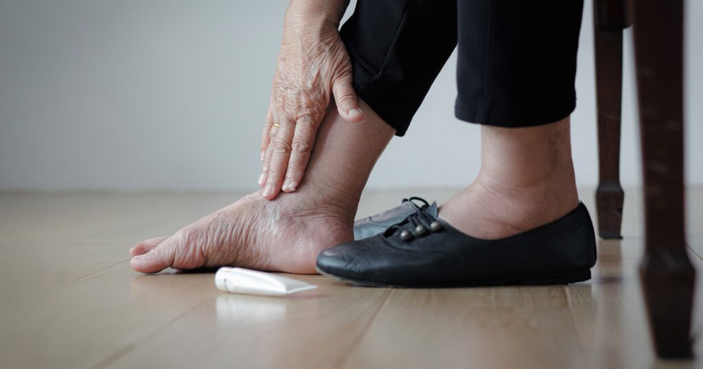 Older woman experiencing pain and tired legs