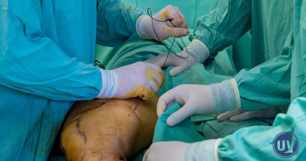 A vein specialist performing vein treatment on patient