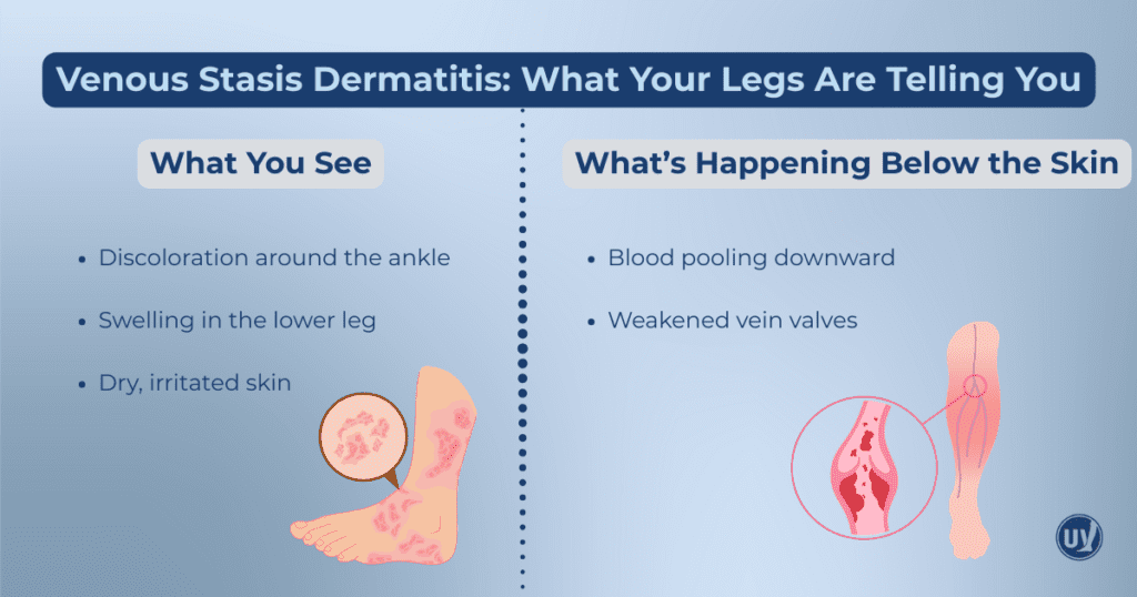 Graphic listing what your legs might be telling you for Venous Stasis Dermatitis