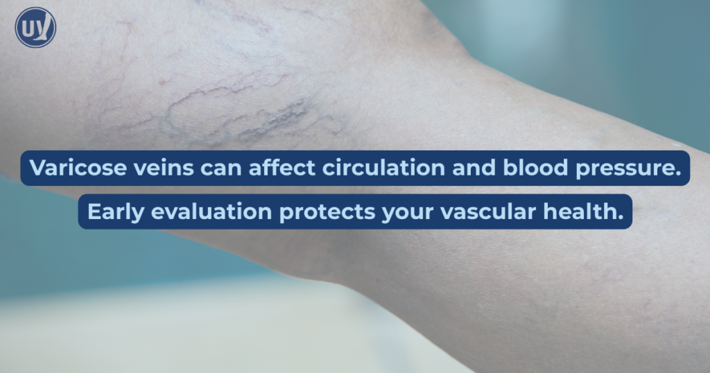 Graphic of varicose veins saying Varicose veins can affect circulation and blood pressure. Early evaluation protects your vascular health.