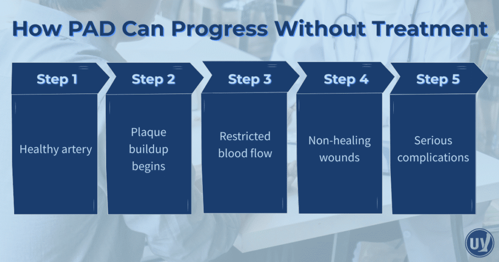 How PAD can progress without treatment.