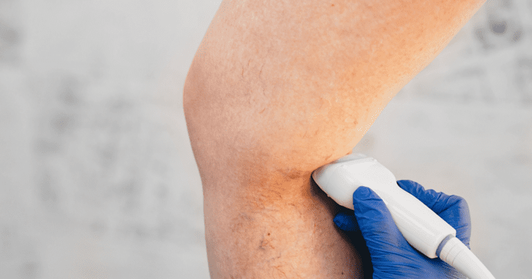 Early Detection and Prevention Strategies for Deep Vein Thrombosis