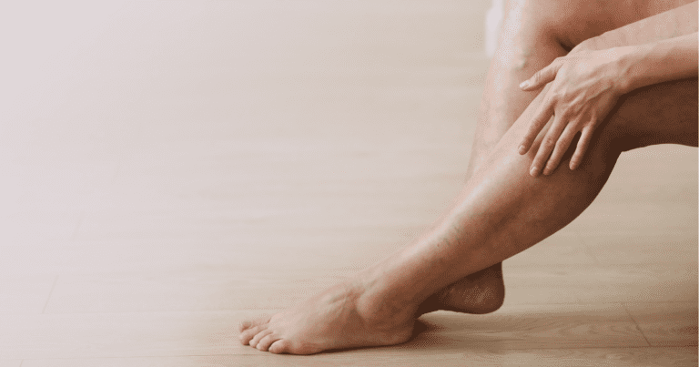 Spider Veins vs. Varicose Veins: Understanding the Differences and Treatment Implications