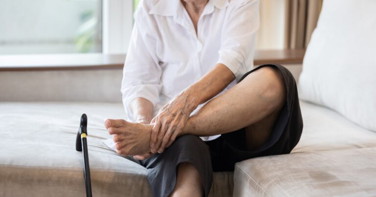 A female senior citizen is sitting on the edge of a holding her swollen feet due to PAD.