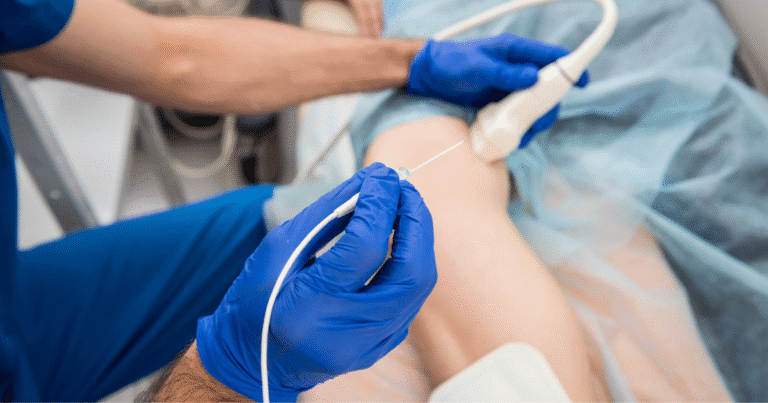 Image of Radiofrequency Ablation procedure on a patient.