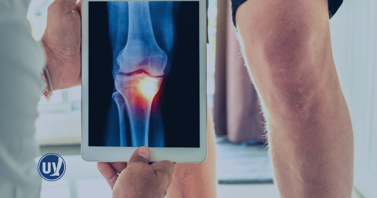 Vascular specialist looking at patient's knee x-ray.