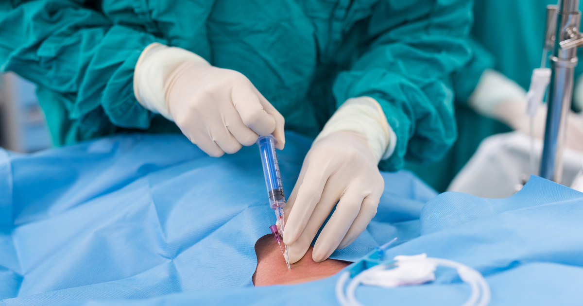 How to Choose the Right Vein Doctor for You