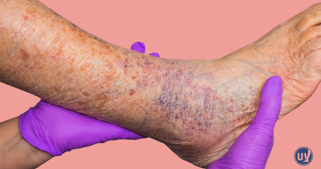 Example of leg skin discoloration.