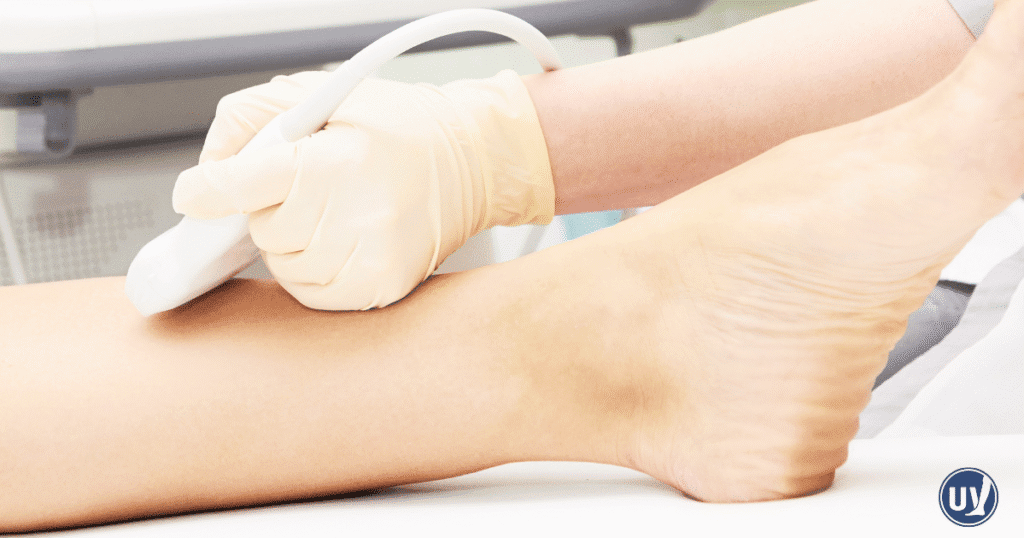 vein consultation