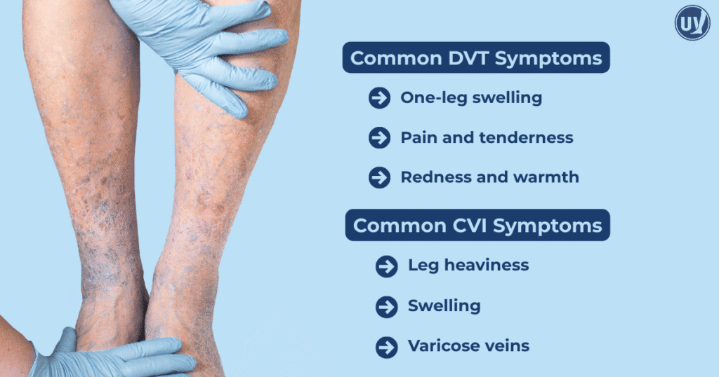Common symptoms of DVT and CVI