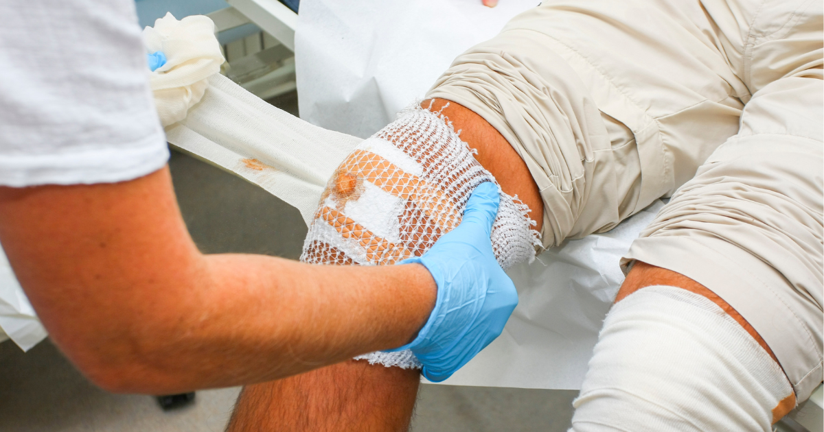 Living With Venous Ulcers: Daily Wound Care & Prevention Strategies