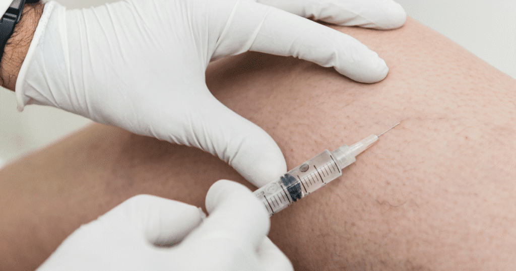 Foam vs. Liquid Sclerotherapy: What’s the Difference and Why It Matters