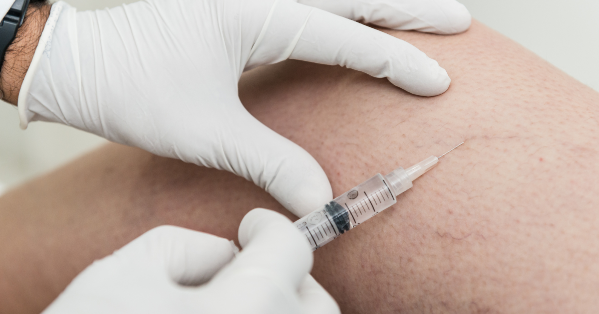 Foam vs. Liquid Sclerotherapy: What’s the Difference and Why It Matters