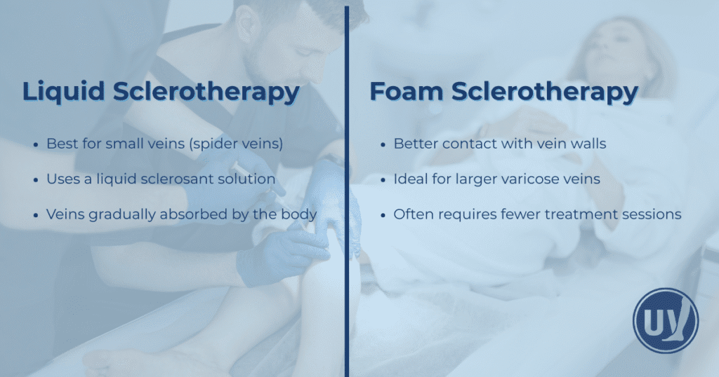 Foam vs. Liquid Sclerotherapy