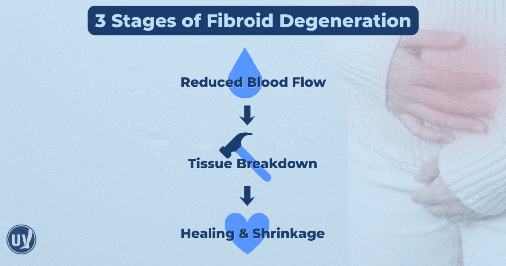 3 stages of fibroid degeneration
