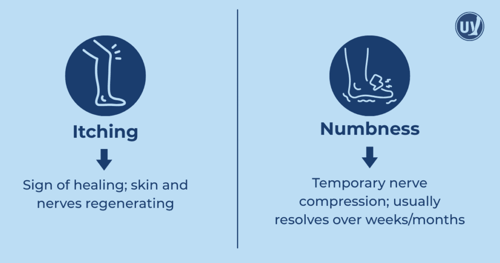 Illustration detailing the common itching and numbness that can occur after vein treatment