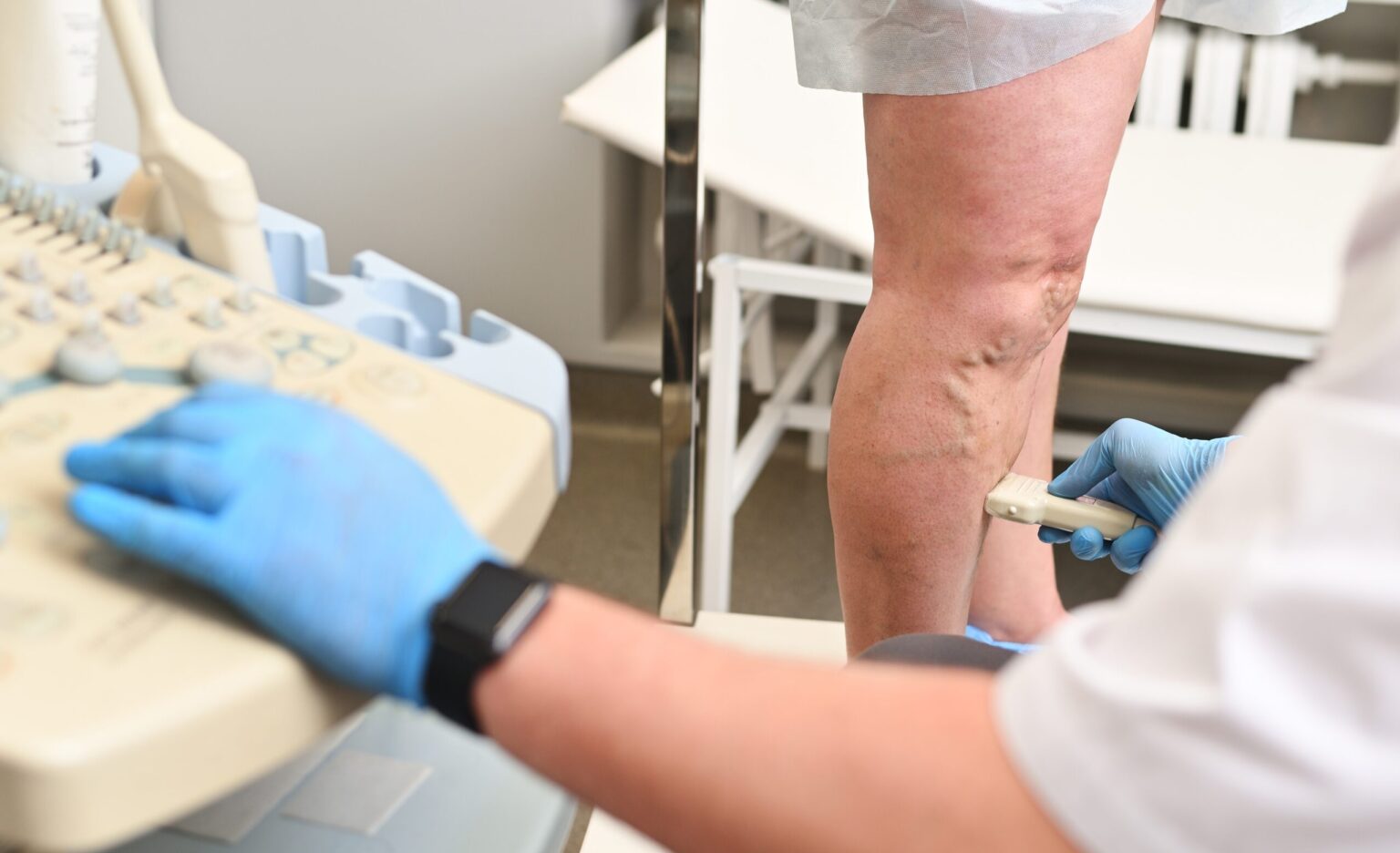 Foam vs. Liquid Sclerotherapy: Choosing the Right Treatment
