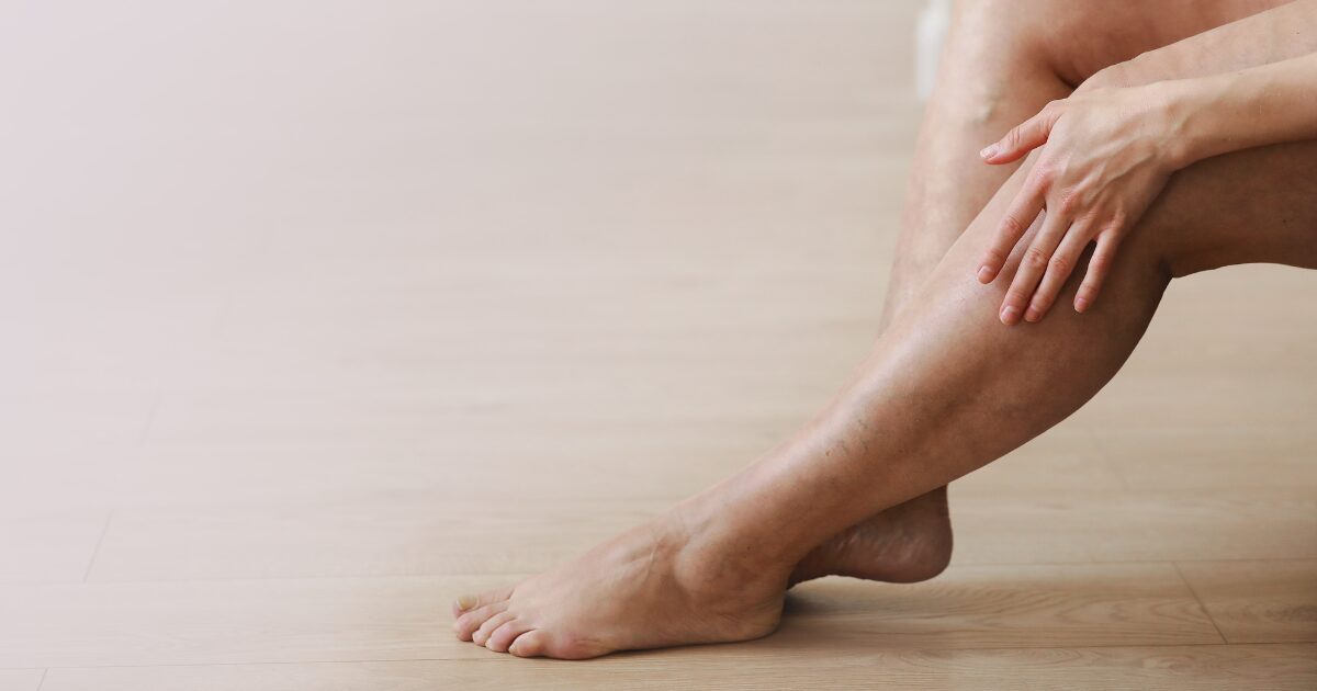 The Science Behind Vein Reflux and Chronic Venous Disease