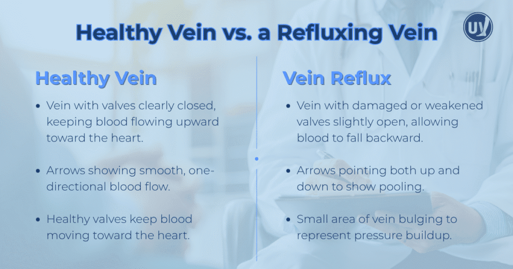 Healthy vein vs. a refluxing vein