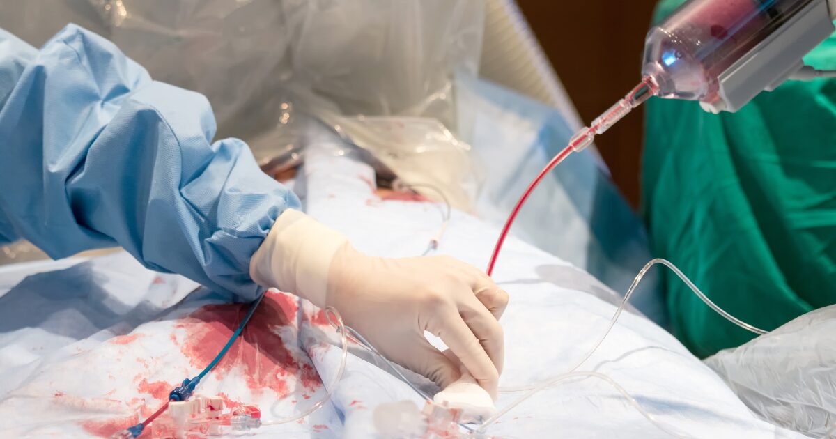 Navigating Post-Angioplasty Care: What to Expect & How to Recover