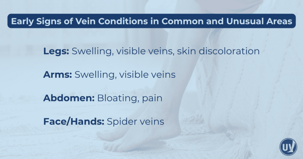 Early signs of vein conditions in common and unusual areas.