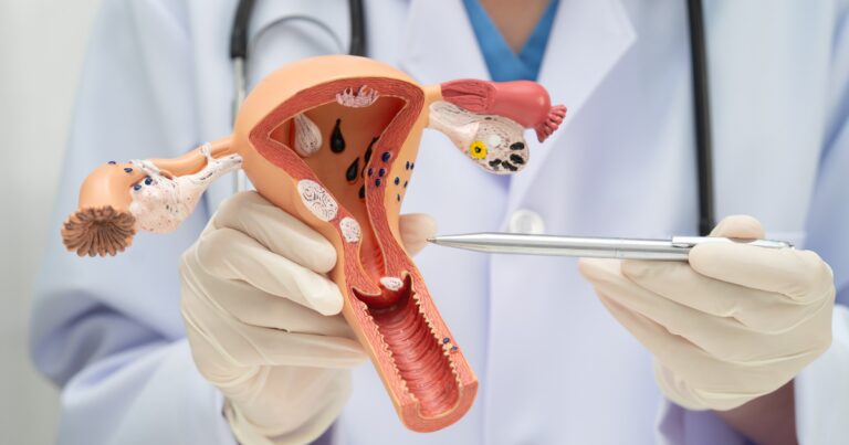 Vascular specialist showing how fibroid treatment can help without major surgery