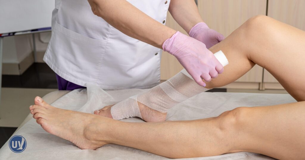 Patient getting leg wrapped for compression therapy to help avoid lymphedema post surgery