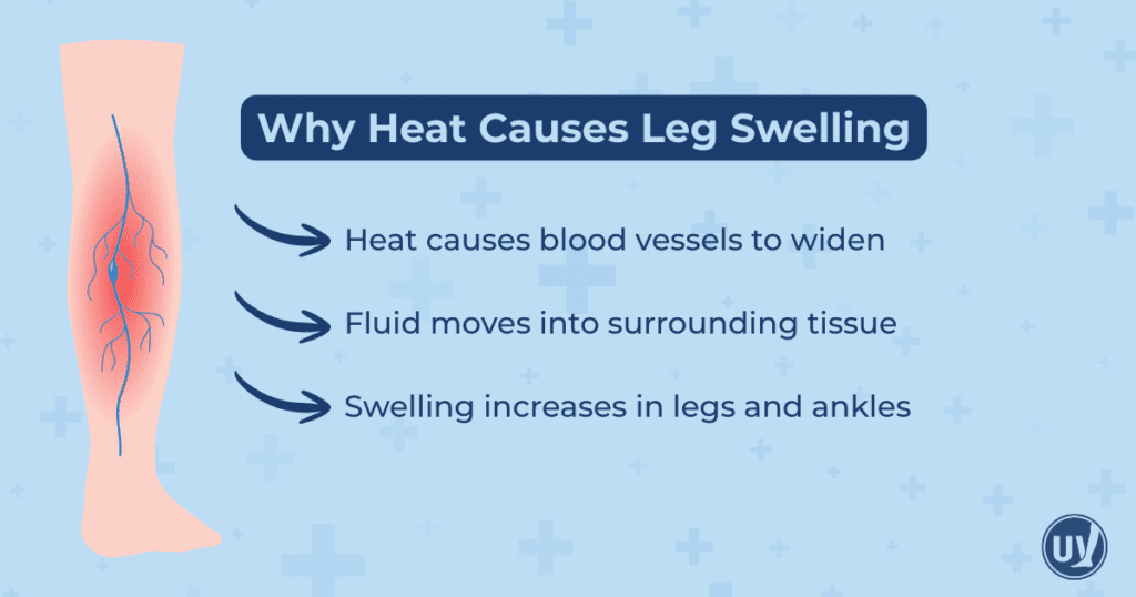 Graphic explaining why heat causes leg swelling