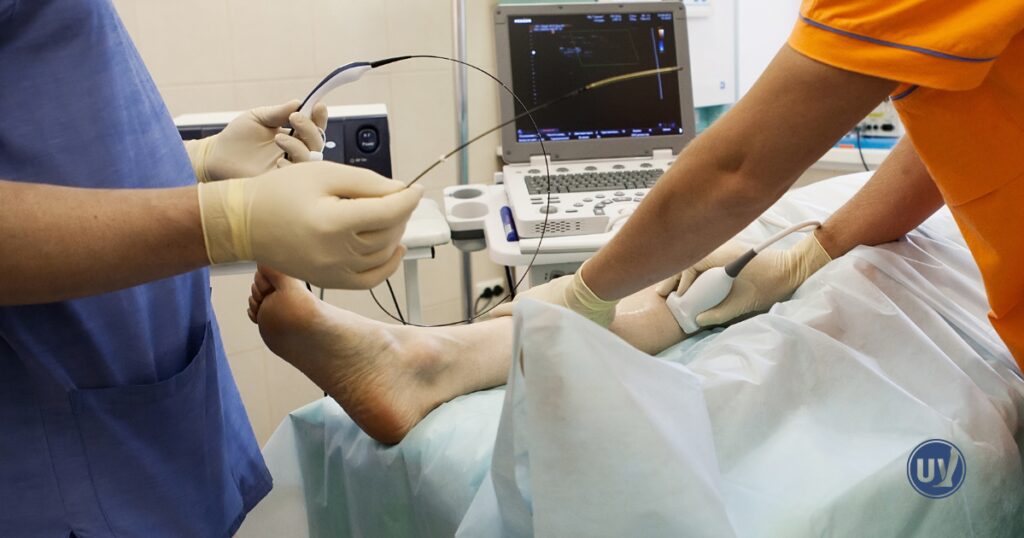 Vein treatment being performed on patient