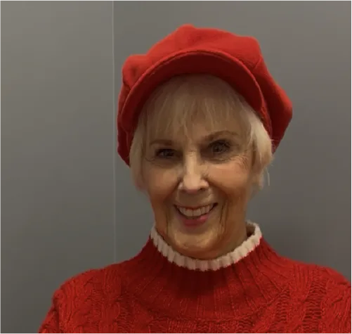 Joan P. of Orland Park, IL after vein treatment from United Vein & Vascular Centers