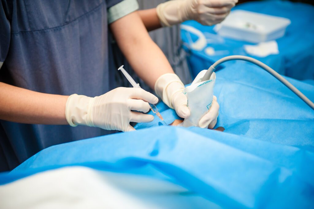 Image of sclerotherapy being performed on a patient