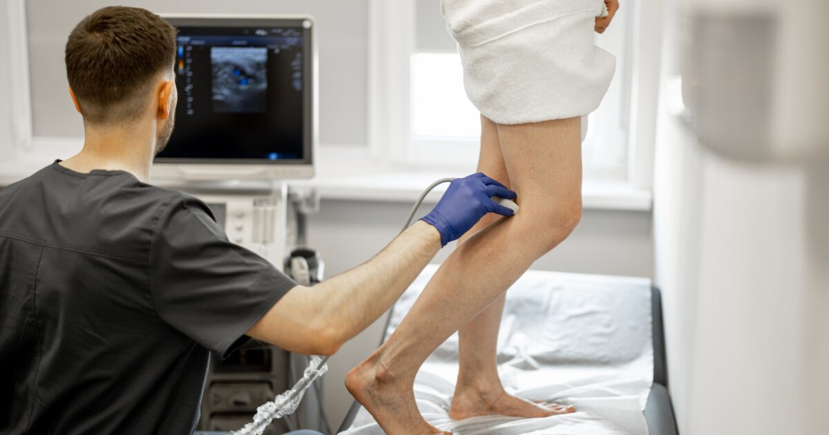 vein specialist using ultrasound on leg veins