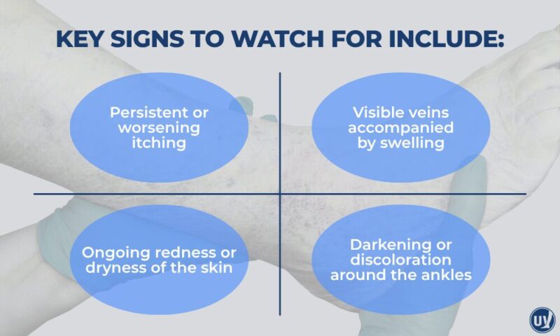 An illustration describing keys signs to watch for that may indicate vein disease