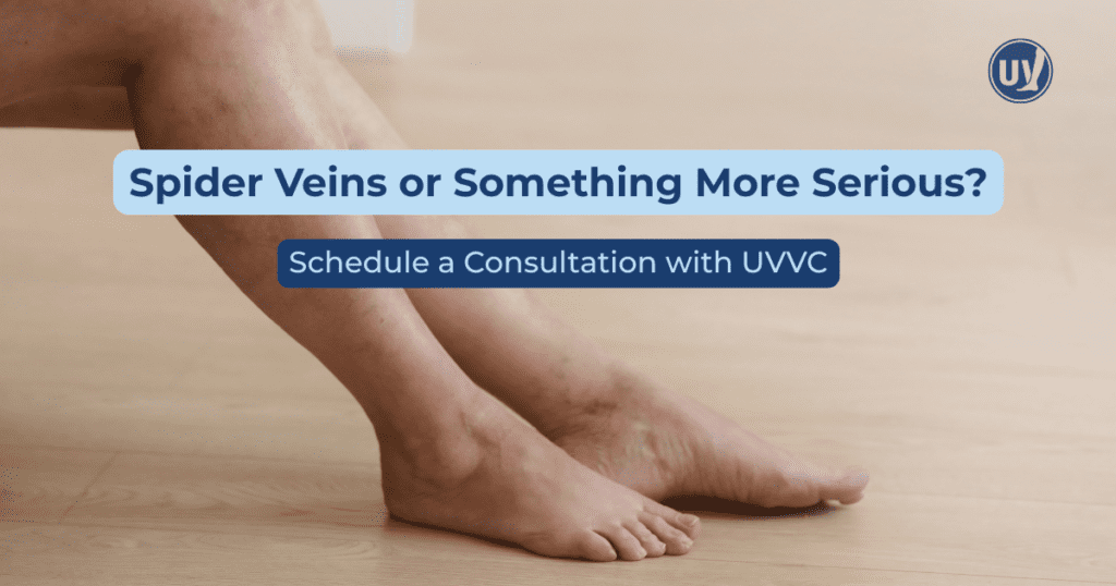 Image of legs with text overlay spidere veins or something more serious? schedule a consultation with UVVC