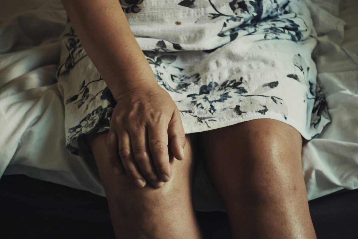 An elderly woman sits on a bed holding her swollen legs