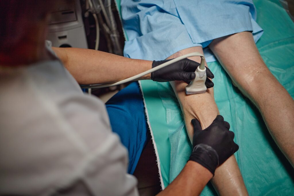 Advanced vein treatment at Tampa OBL