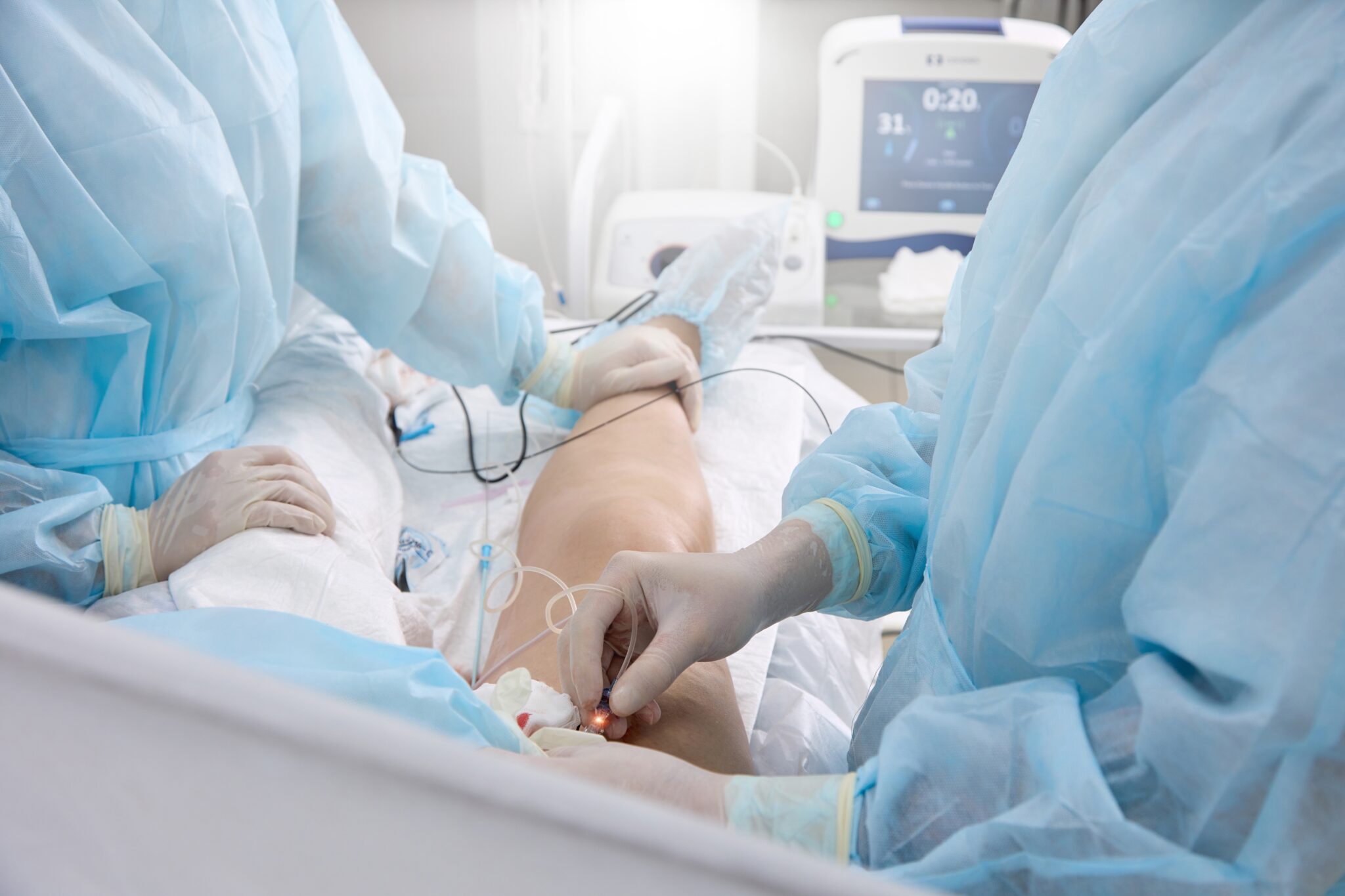 https://unitedveincenters.com/wp-content/uploads/2026/04/vein-ablation-procedure-1024x683.jpg