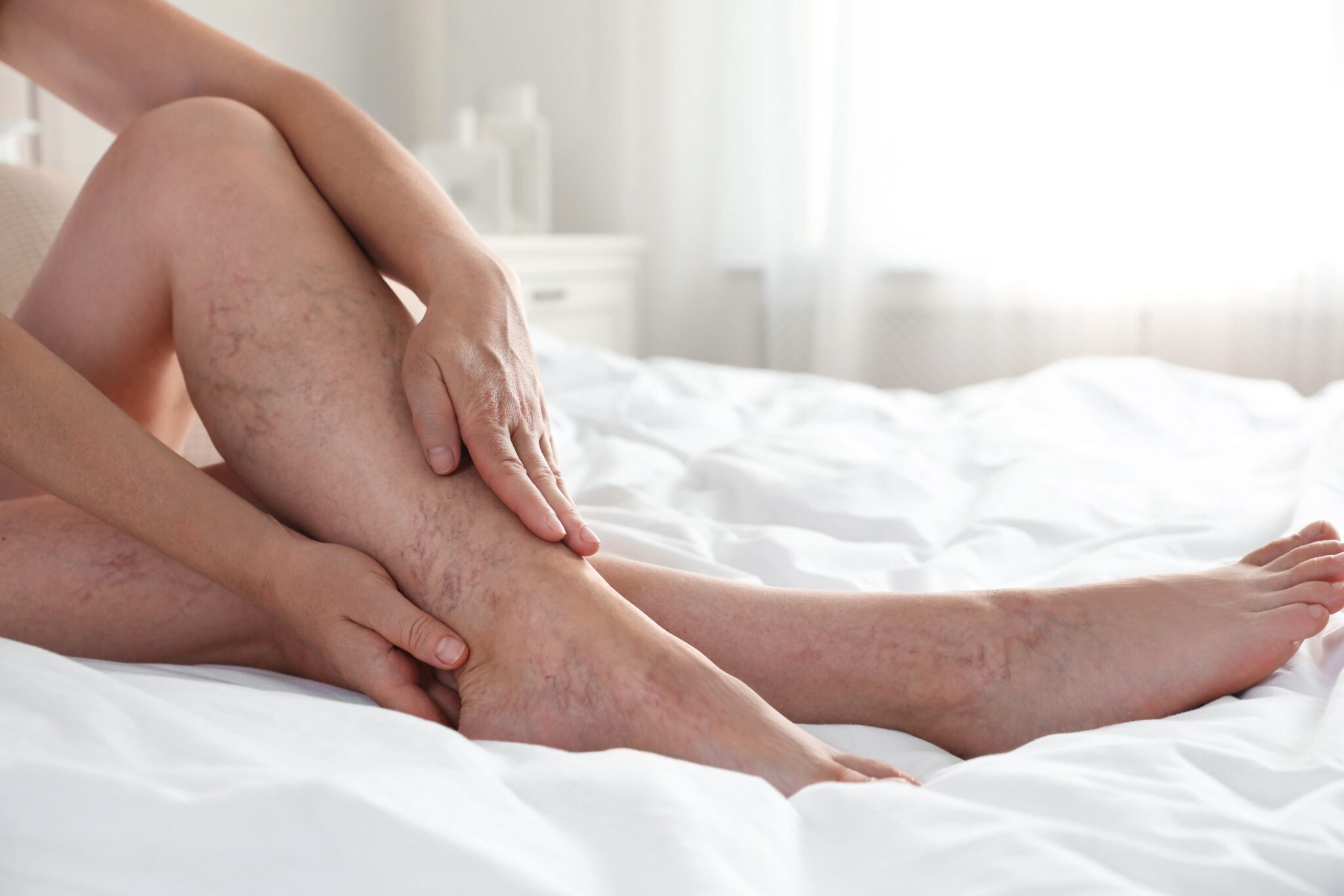 https://unitedveincenters.com/wp-content/uploads/2026/04/vein_issues_treated_with_ablation-1024x683.jpg