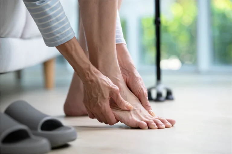 A woman is rubbing the sore veins in her feet