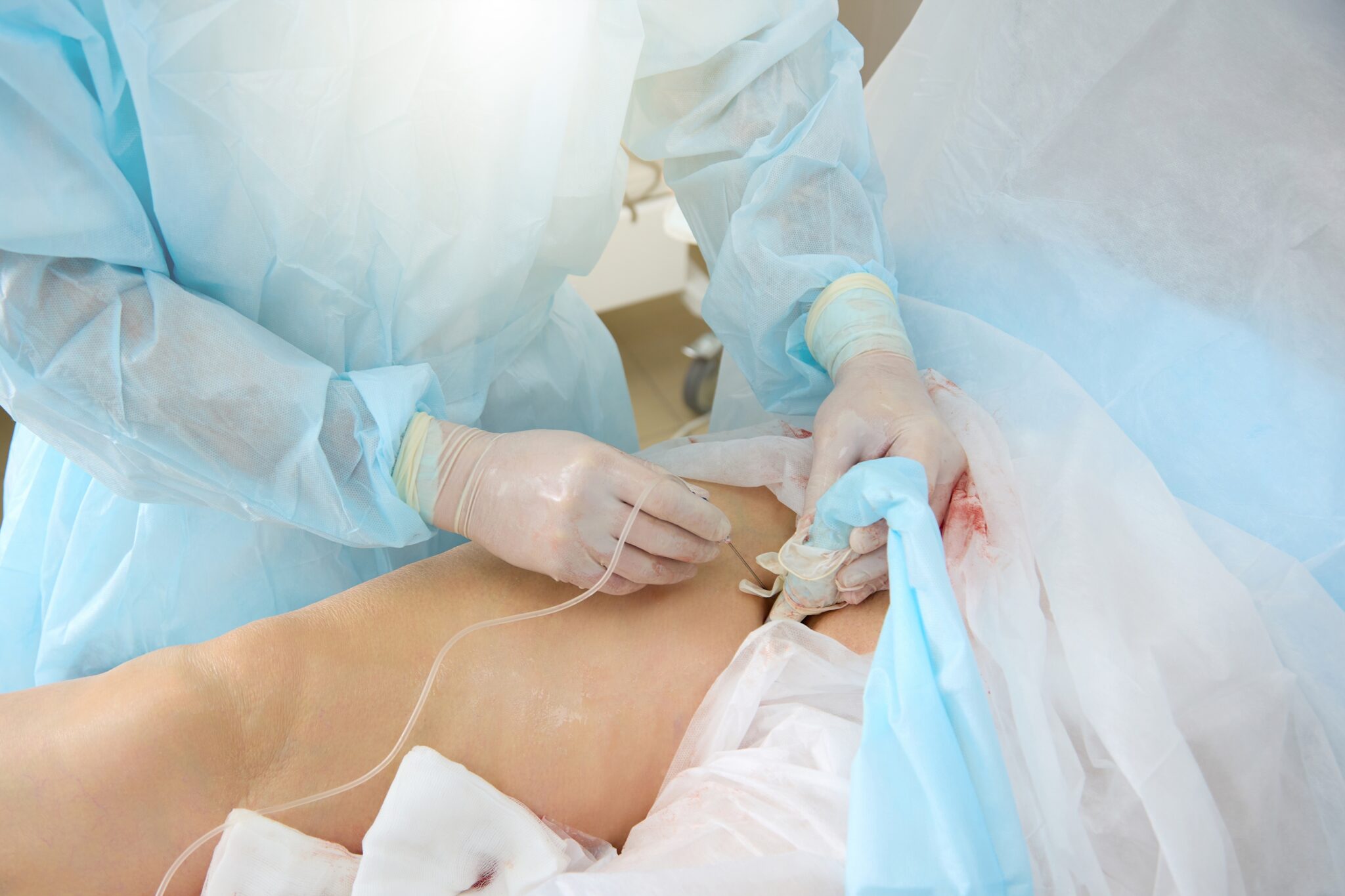 https://unitedveincenters.com/wp-content/uploads/2026/04/vein_removal_procedure-1024x683.jpg