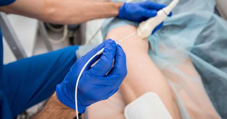 Minimally Invasive Varicose Vein Treatment Available in Naperville