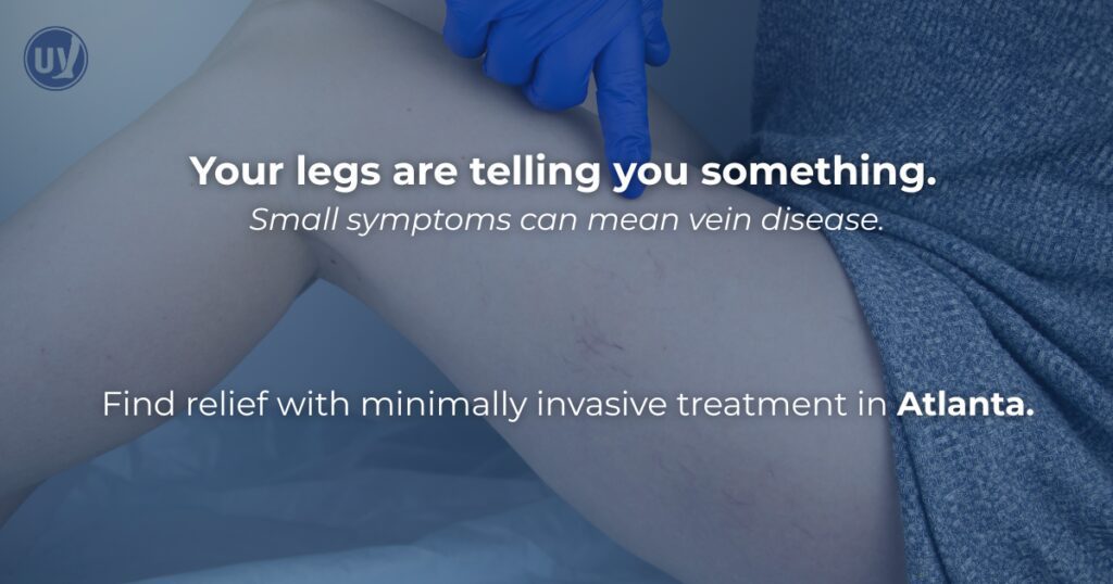 Find vein pain relief with minimally invasive treatment in Atlanta.