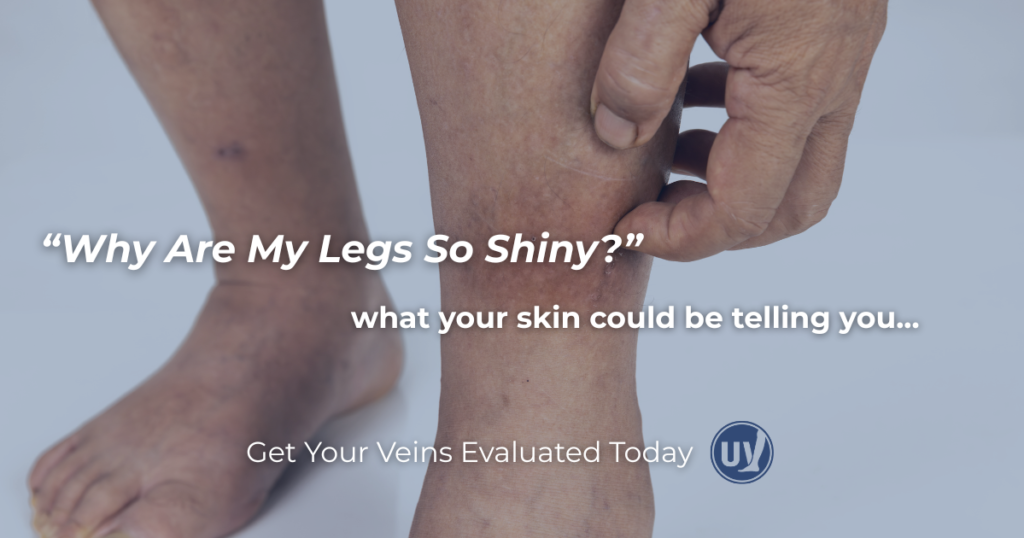 why are my legs so shiny and what your skin could be telling you