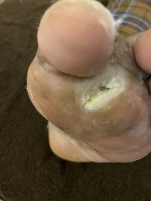 https://unitedveincenters.com/wp-content/uploads/2026/05/leschack_patient_1-1024x1365.jpg