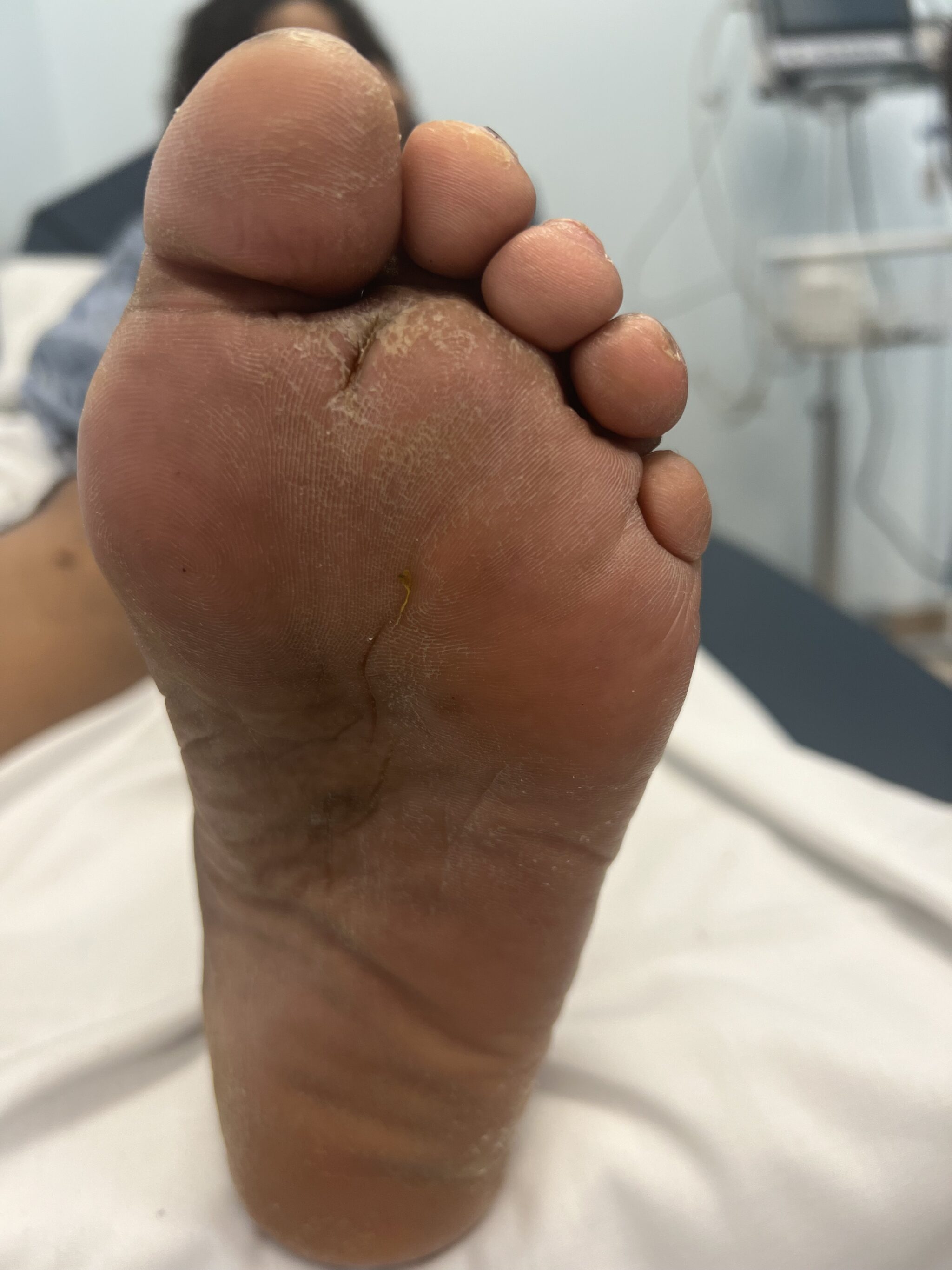 https://unitedveincenters.com/wp-content/uploads/2026/05/leschack_patient_1_after-1024x1365.jpg