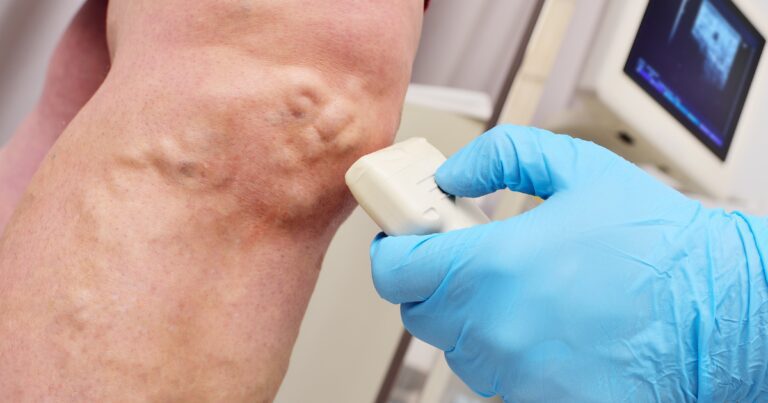 Vein doctor in Phoenix using ultrasound on patient vein